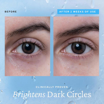Livenra Eye Gel
